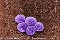 代替抗生素來殺菌 研究：超短脈衝光殺死99.9％以上超級細菌MRSA