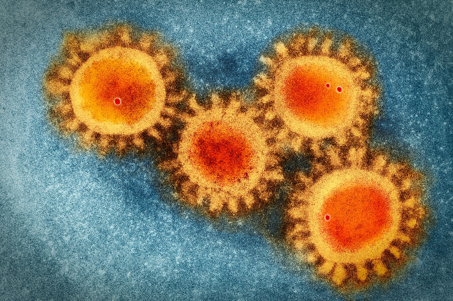 新型冠狀病毒在電子顯微鏡下的影像，表面突起的棘蛋白，是它們進攻細胞的重要武器。 圖片來源│iStock 