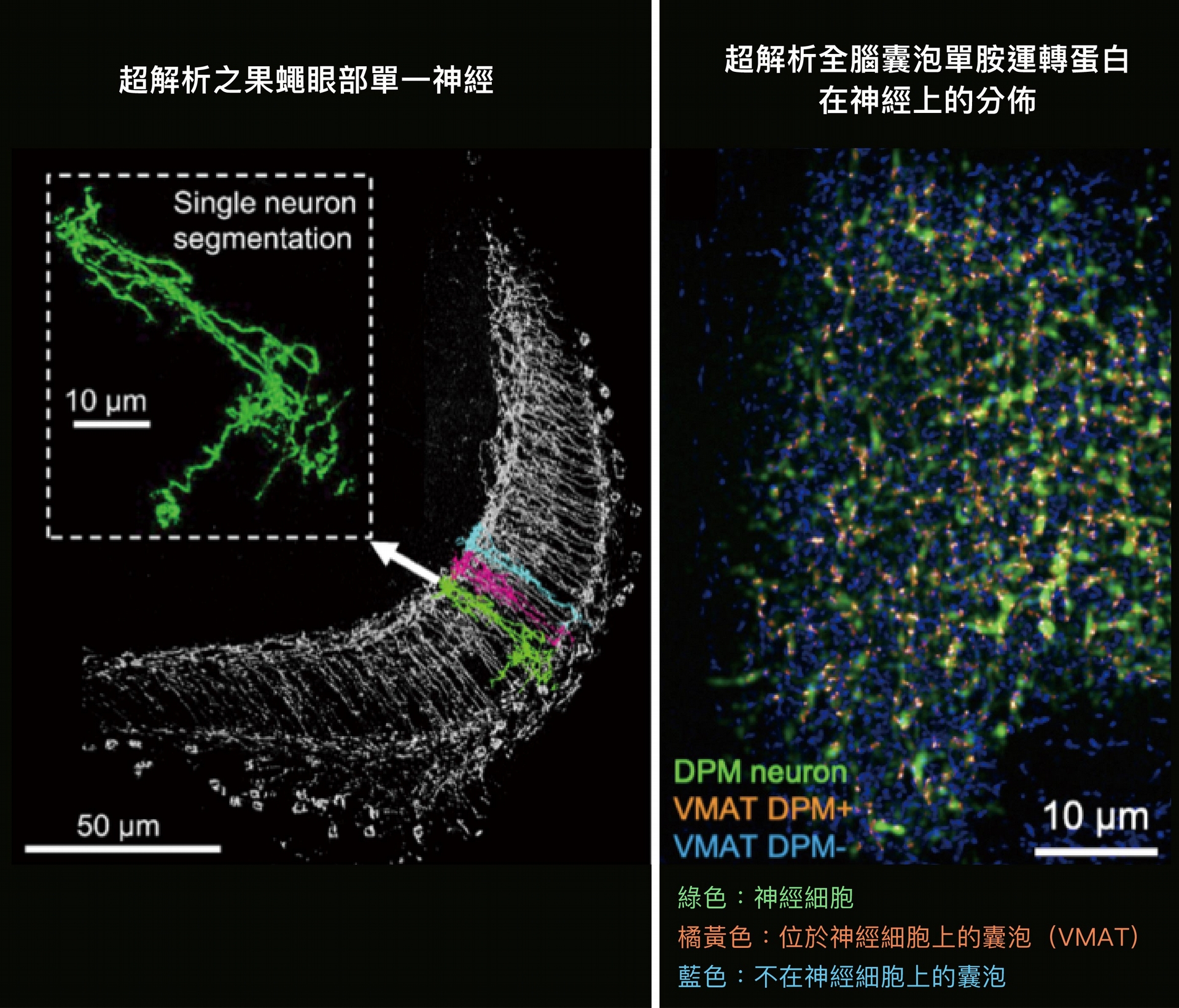 左圖是超解析之果蠅眼部單一神經，右圖是超解析全腦囊泡單胺運轉蛋白在神經上的分佈。 圖片來源│Rapid single-wavelength lightsheet localization microscopy for clarified tissue 