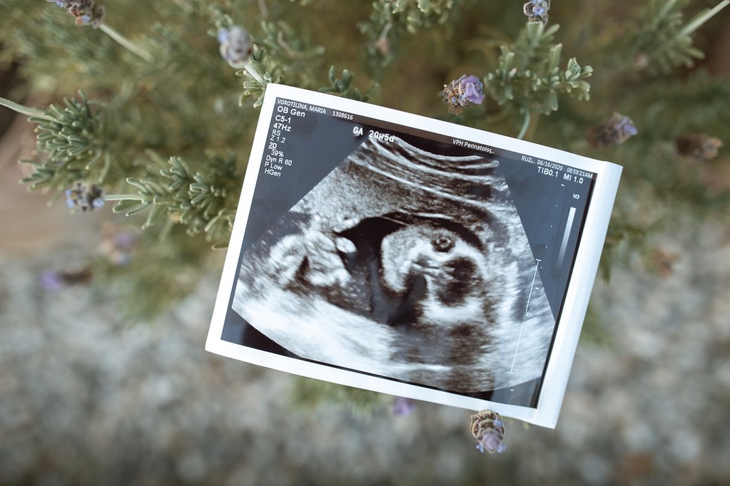 科學界首次在人類胎盤中發現了塑膠微粒，研究人員表示這「非常令人擔憂」。示意圖。照片來源：Rodnae／pexels