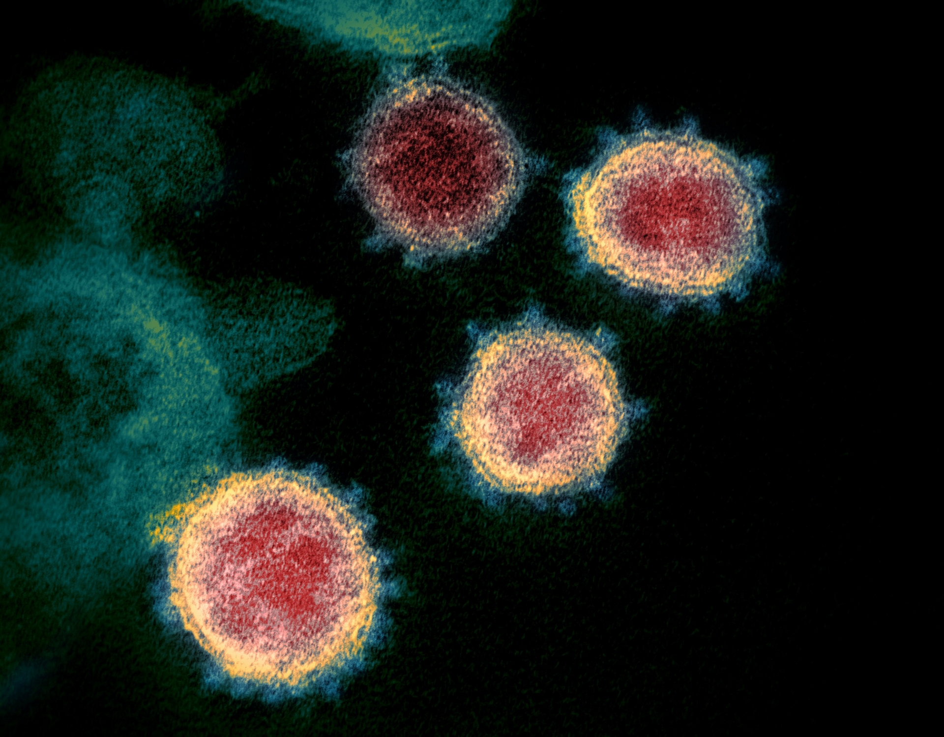 新冠病毒在穿透式電子顯微鏡下現形，可見病毒表現突起的棘冠。因新冠病毒是 RNA 病毒，突變速度快。中研院團隊將目前新冠病毒變異分為六大類型，目前全球流傳的幾乎都是第六類型病毒，未來團隊將持續追蹤病毒變異。 圖│維基百科 