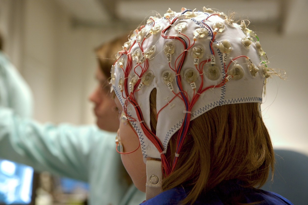 量測腦電波時，受試者需要戴上多個電極的帽子，以非侵入的方式量測頭皮電位。 圖│iStock 