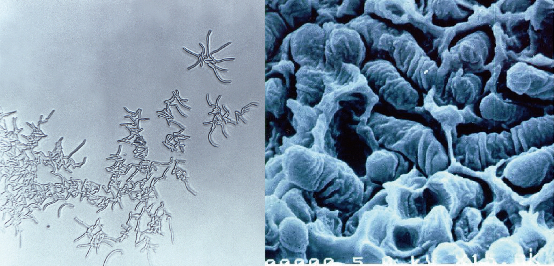 <i>Rhodococcus</i> 屬細菌於光學顯微鏡（左）與電子顯微鏡（右）下的成像。圖／microbewiki