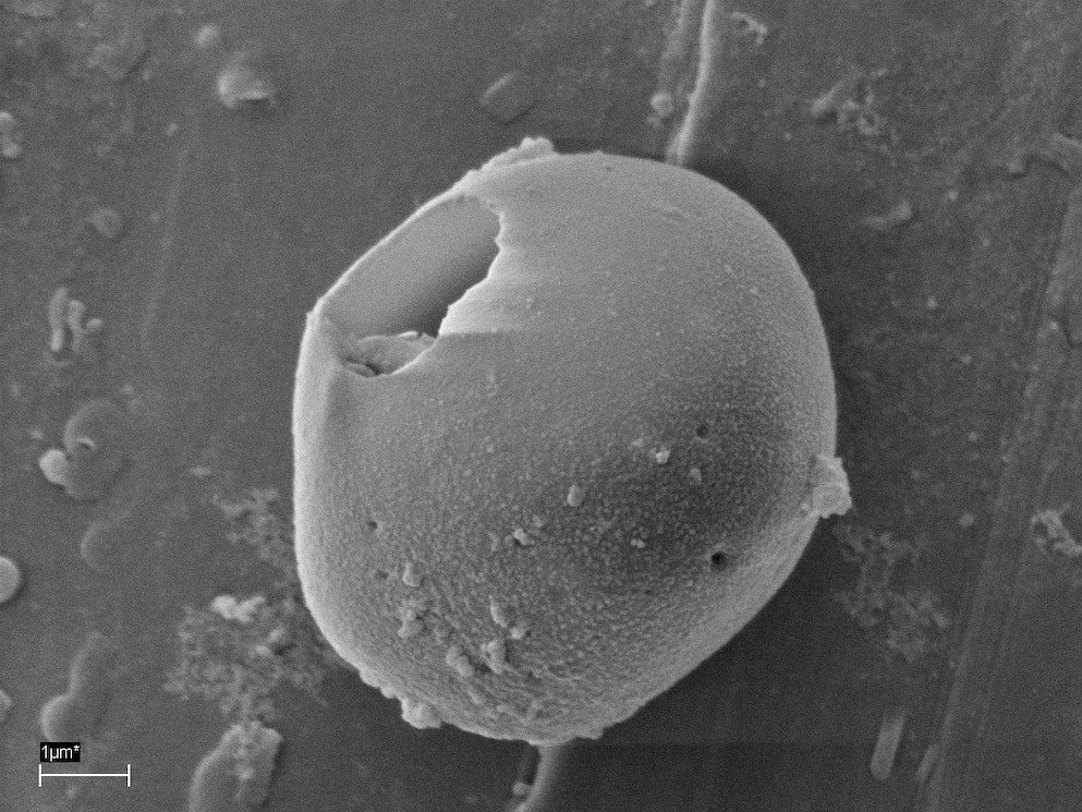 這項分析找到了像微型藻類（上）和寄生蟲卵（下）之類的微小海洋物體。　PHOTOGRAPH BY PROFESSOR ALVARO ANDRADE