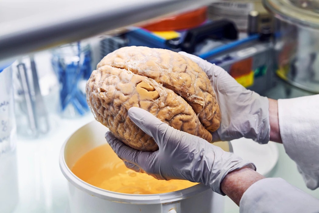 一名技術人員準備將一顆捐贈的腦進行保存。這類器官標本對於研究COVID-19、神經退化性疾病、老化對腦的影響至關重要。PHOTOGRAPH BY LUCA LOCATELLI FOR NATIONAL GEOGRAPHIC