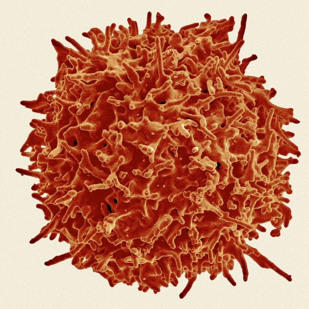 人類T細胞的色彩增強掃描式電子顯微圖，該細胞來自一名健康捐贈者的免疫系統。T細胞屬於白血球的其中一類，在保衛身體對抗病毒（包括導致COVID-19的SARS-CoV-2）方面扮演了重要角色。SCIENCE SOURCE