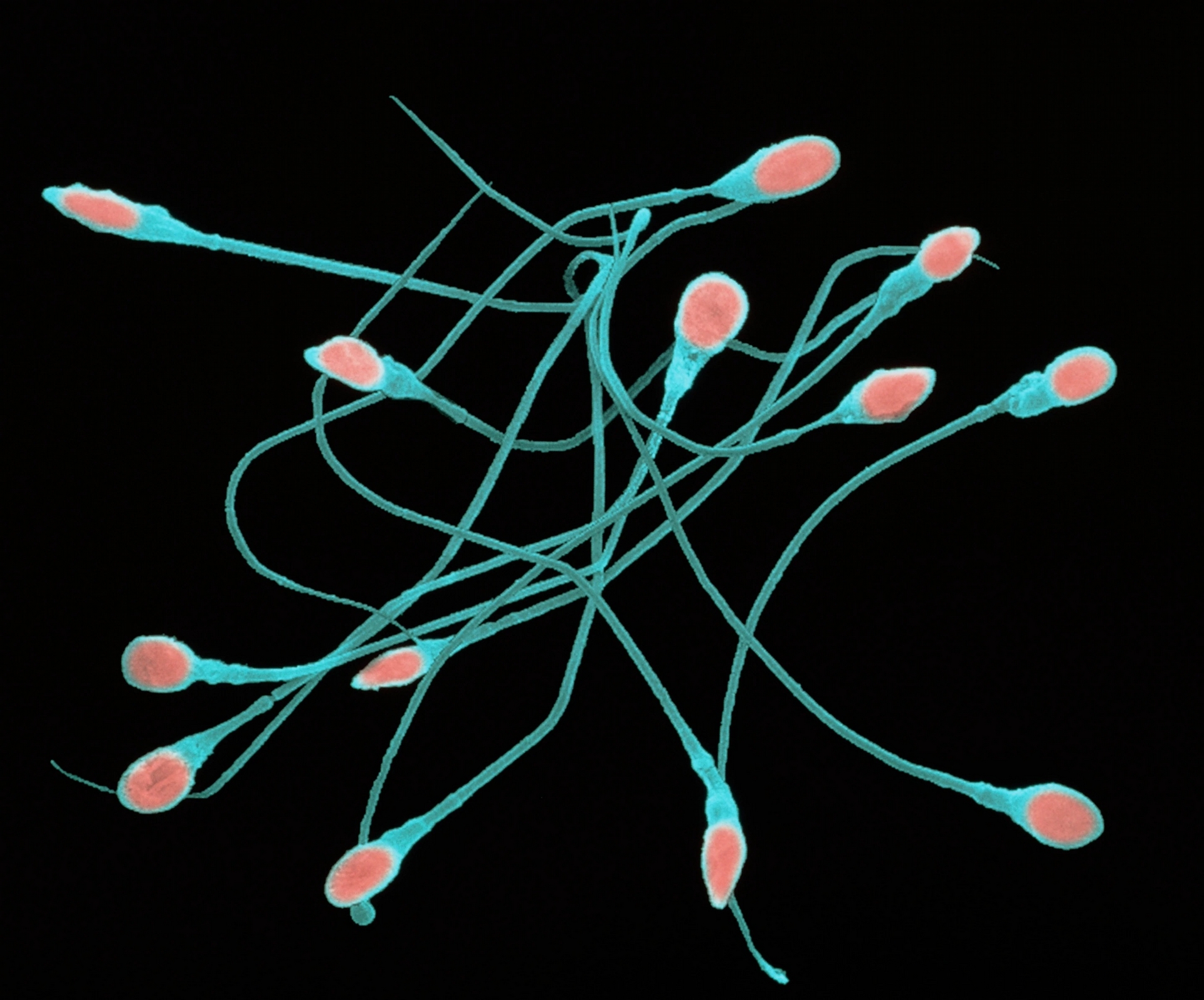 數個成熟人類精子（又稱為精蟲）的彩色掃描式電子顯微影像（SEM）。每個精子的長度大約是65微米，可大致分成頭部（紅色）、頸部和尾部（藍色）。MICROGRAPH BY DR TONY BRAIN, SCIENCE PHOTO LIBRARY 