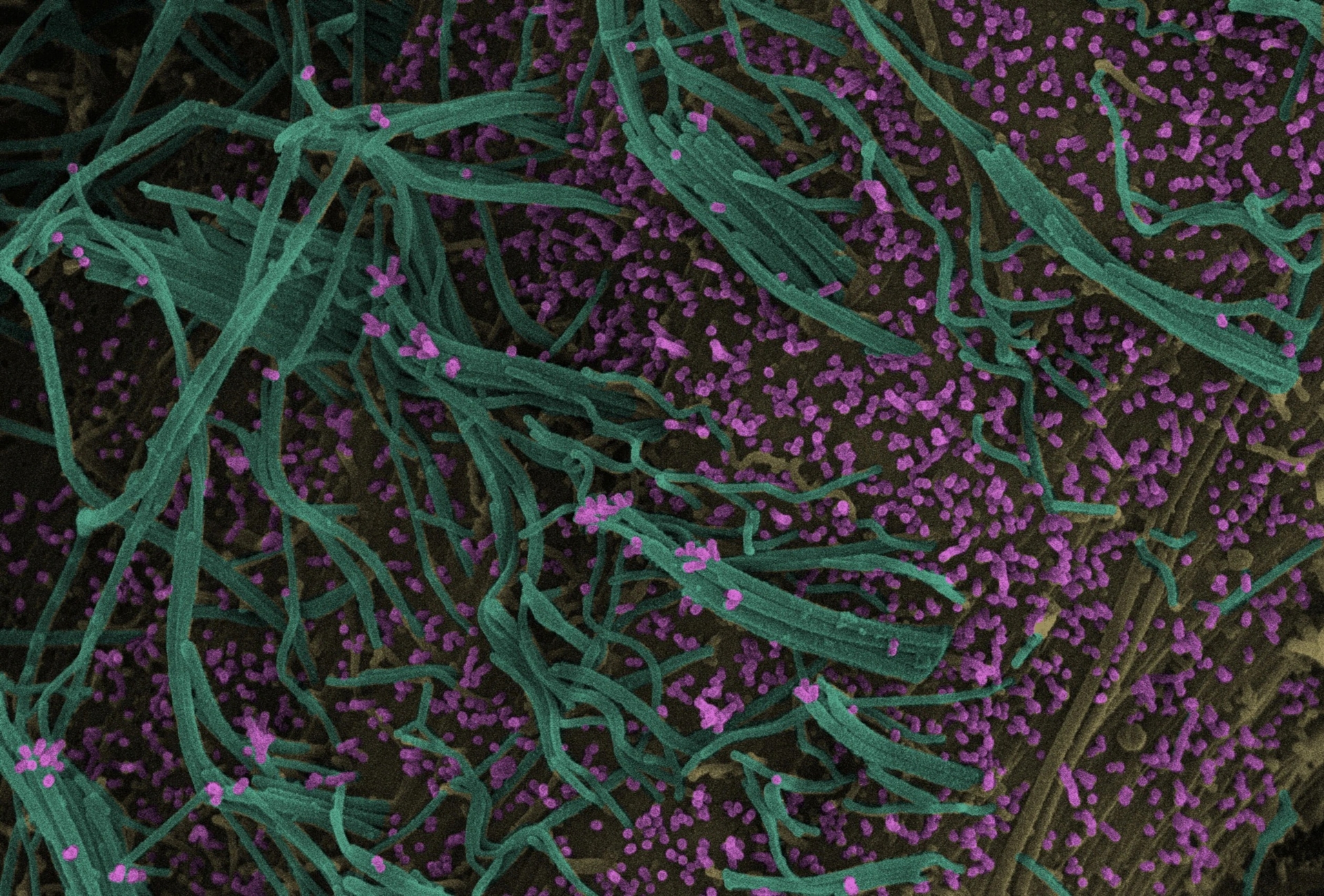掃描式電子顯微鏡的影像顯示，同時感染A型流感和呼吸道融合病毒（RSV）的人類肺細胞會製造雜交病毒顆粒。流感病毒顆粒（粉色）和RSV細絲（綠色）從細胞表面（黃色）突出，而雜交病毒顆粒同時含有類似流感病毒及RSV的區域。PHOTOGRAPH BY JOANNE HANEY AND MARGARET MULLIN, UNIVERSITY OF GLASGOW CENTRE FOR VIRUS RESEARCH