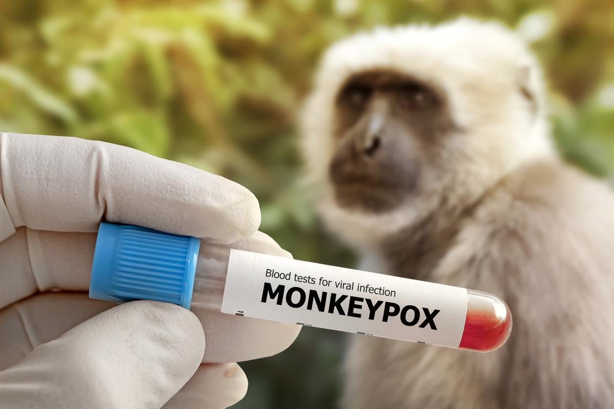 2022 年的猴痘疫情是繼 2020 年新冠肺炎疫情之後的「國際關注公共衛生緊急事件」。 圖｜iStock