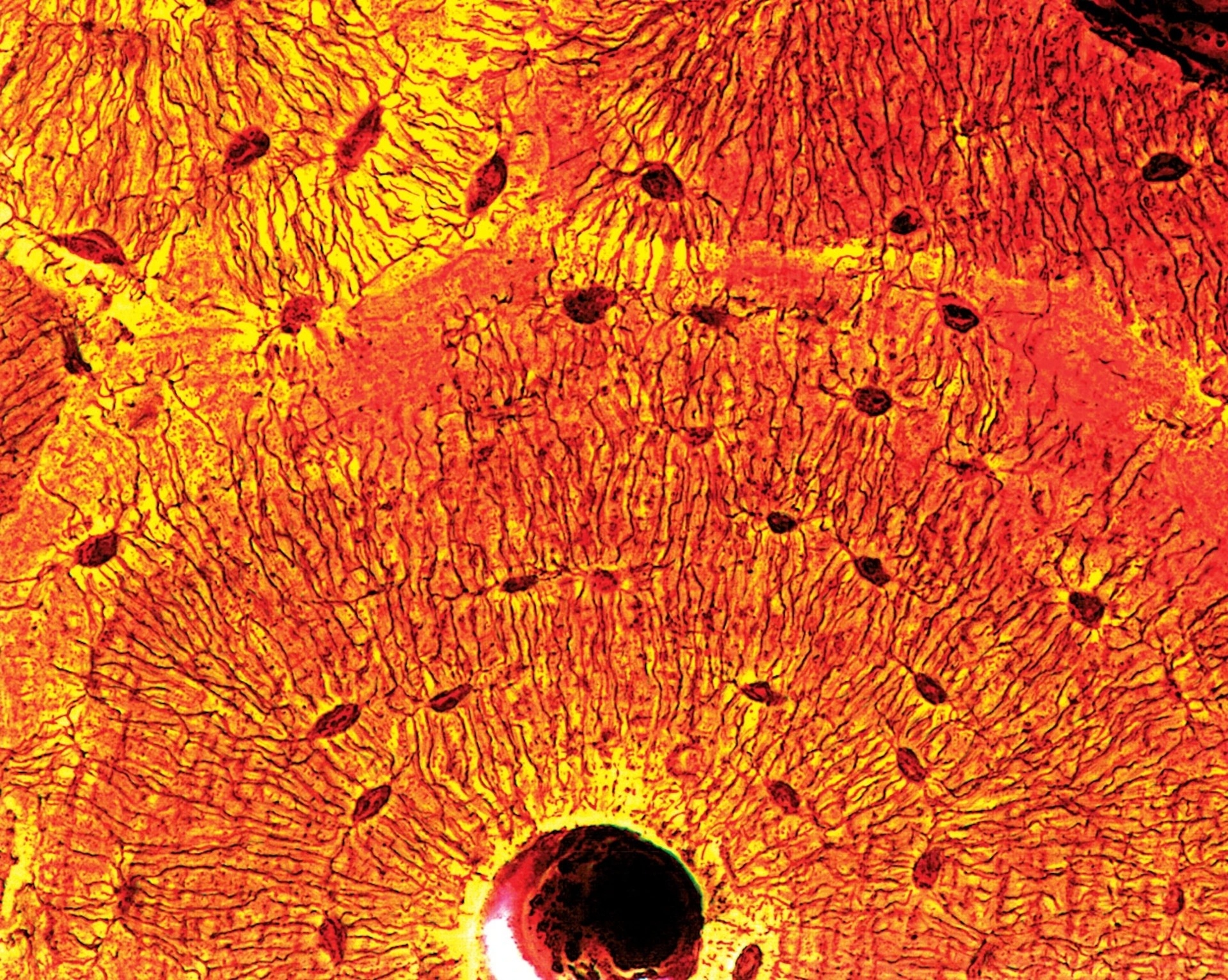 在這幅放大的緻密骨（compact bone）斷面影像中，骨細胞（黑點）──跟骨重塑（bone remodeling）有關的細胞──會往外分枝、連結其他細胞。 PHOTOGRAPH BY QUEST, SCIENCE SOURCE 