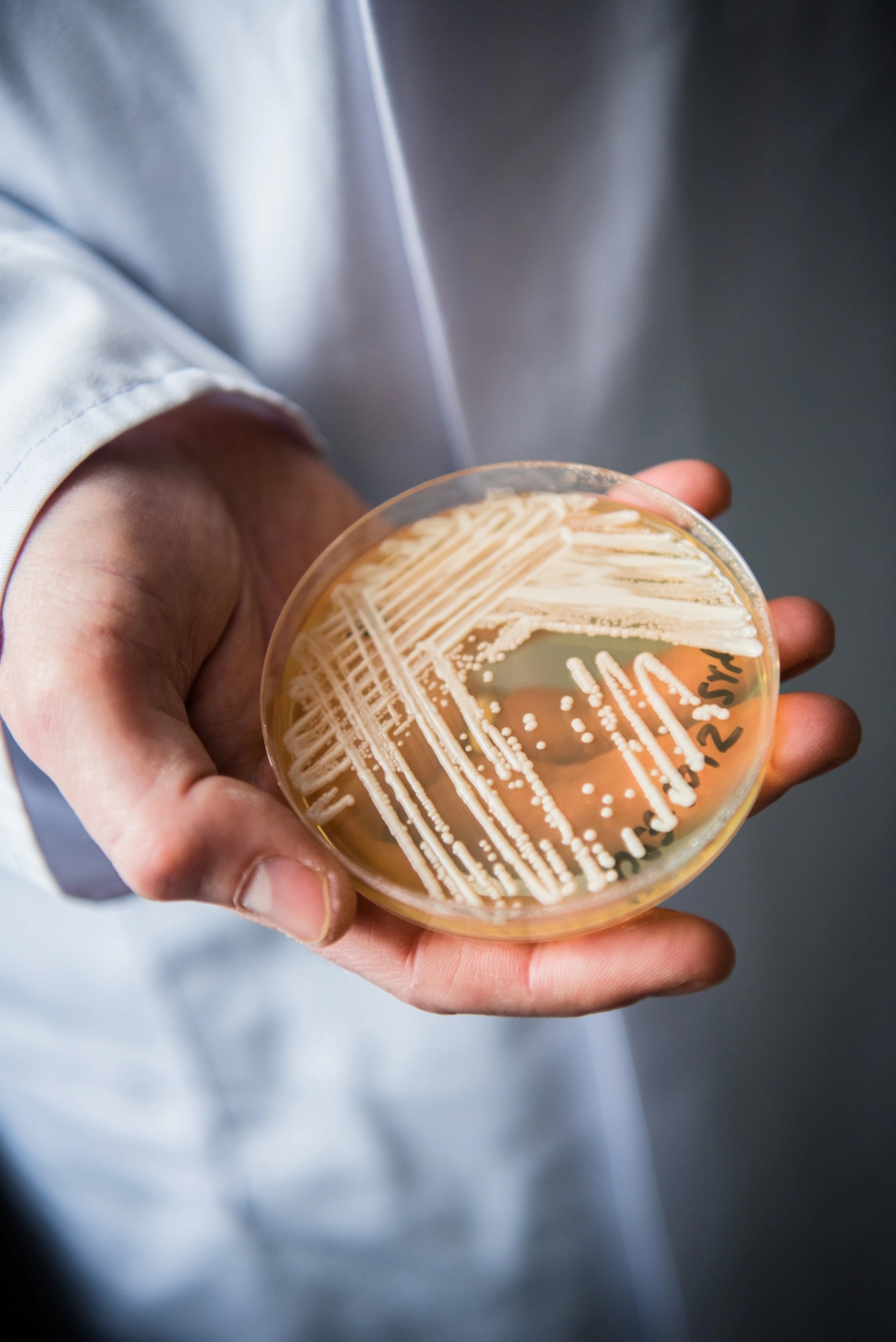 在德國烏茲堡的一間實驗室，科學家拿著一個裝有耳念珠菌的培養皿。這種真菌最先在日本發現，如今已是遍布全球的病原體。PHOTOGRAPH BY NICOLAS ARMER, PICTURE ALLIANCE/GETTY IMAGES 