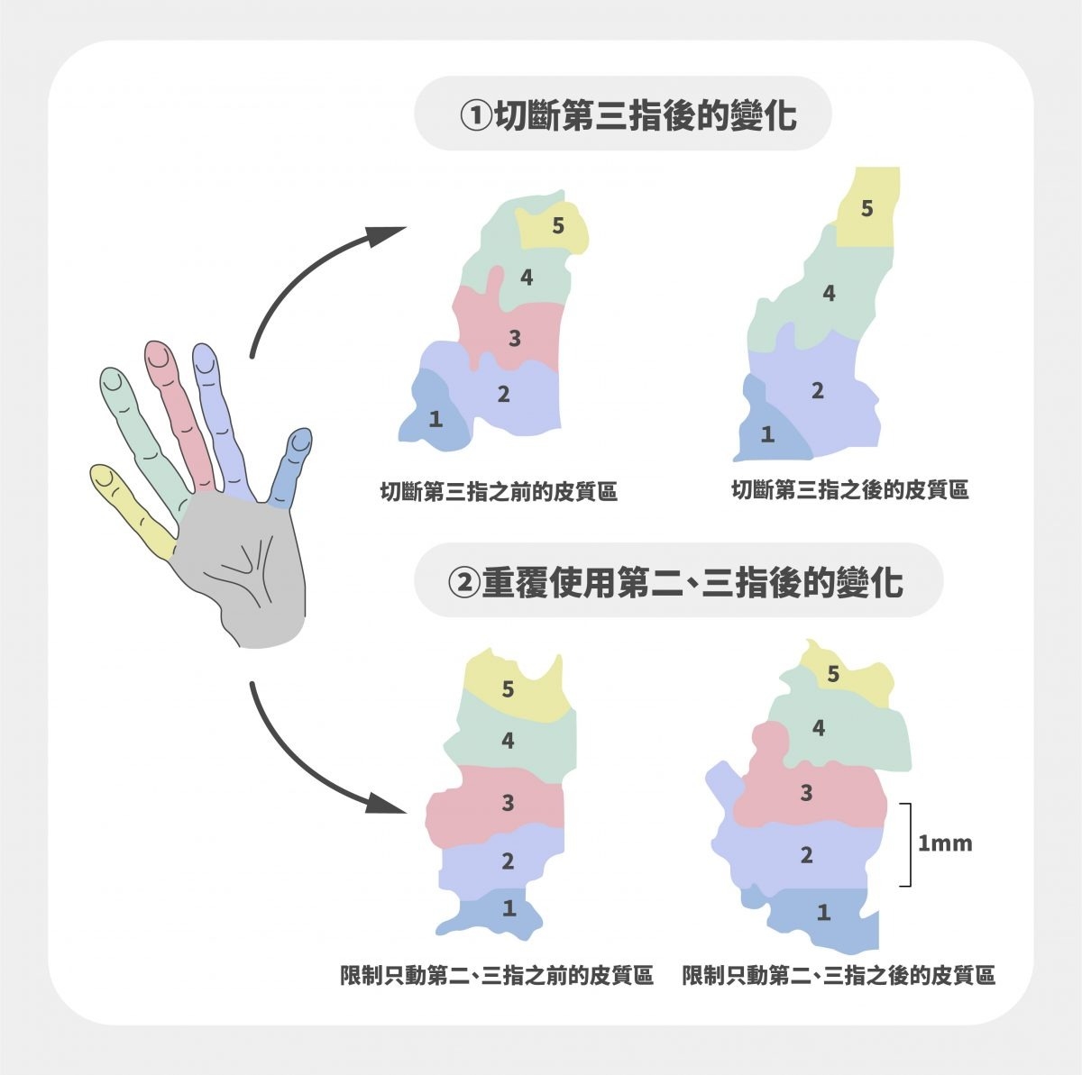 猴子手指運動與相應的大腦皮質區域變化，說明成年腦部具有可塑性。第一個實驗切斷猴子第三指之後，可以看到第三根手指對應的皮質區消失了。第二個實驗只讓猴子第二、第三根手指活動，可以看到第二根手指和第三根手指的對應區域都變大。 圖｜研之有物（資料來源｜程淮榮） 