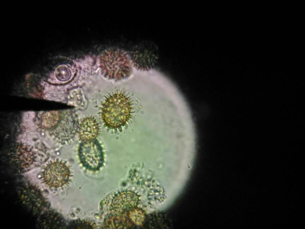 臺東黑松露菌肉內成熟的子囊孢子。圖片來源：林試所