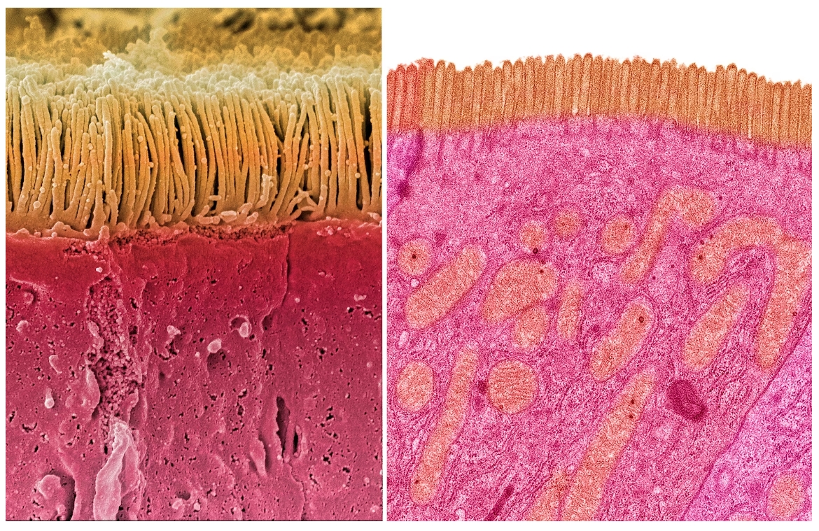 這兩張影像顯示的都是人類小腸細胞內密密麻麻的纖毛，一張是由掃描式電子顯微鏡拍攝（左），另一張則是由穿透式電子顯微鏡拍攝（右）。這些細微的結構在細胞表面形成了一層像刷子般的結構，讓它們能吸收所消化的食物中的養分。 PHOTOGRAPH BY STEVE GSCHMEISSNER, SCIENCE PHOTO LIBRARY 