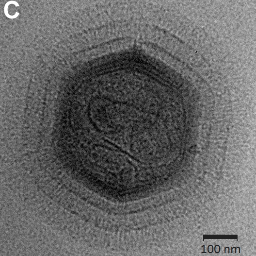 顯微鏡下的米米病毒。 / 圖片來自：PLoS Biol 7(4): e1000092.