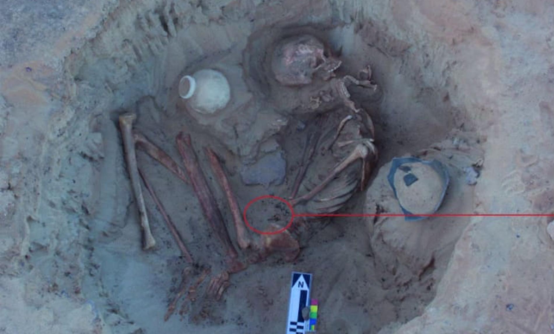 發現死於難產的古埃及屍體，可以告訴我們什麼事？
