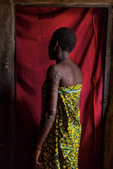 影像藝廊：戰爭撕裂的奈及利亞