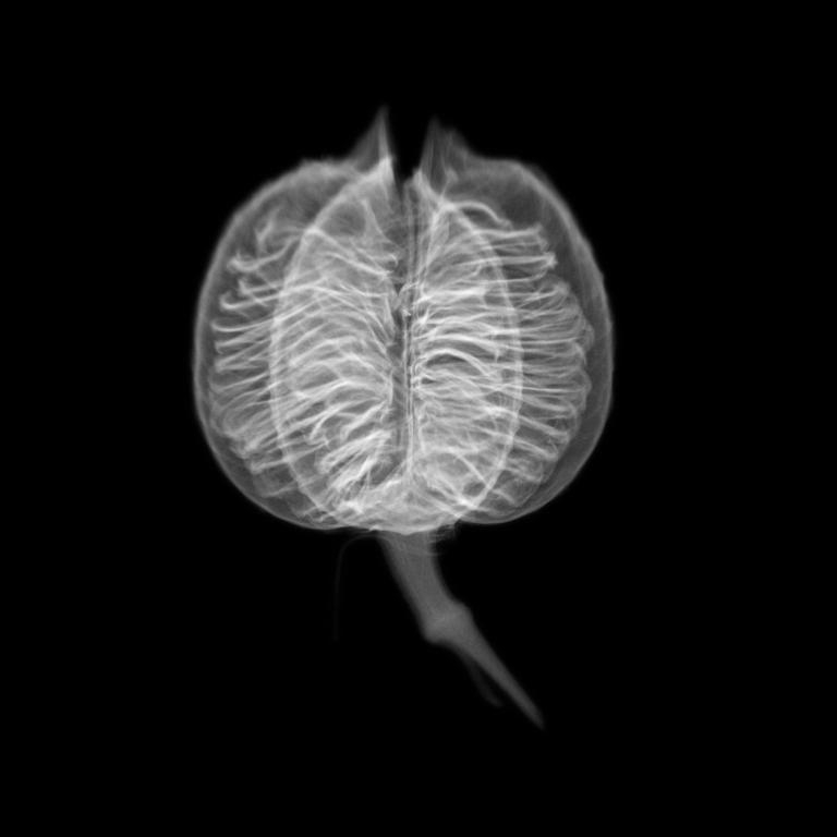 杜荷提製作這張紅絲蘭果實的X光影像，是因為果實的內部結構讓她聯想到種子銀行的建築物。PHOTOGRAPH BY DORNITH DOHERTY