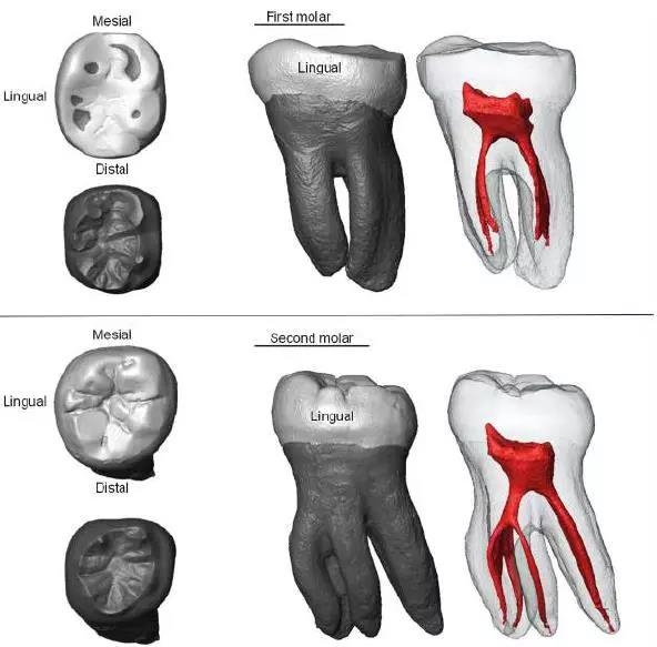 CT掃描獲得的牙齒內部形態，紅色部分是牙髓腔。圖片來源：參考文獻[1]