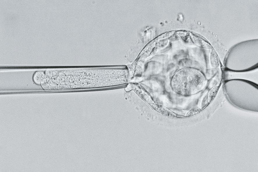 在這幅顯微影像中，科學家仔細審視一個五天大的胚囊（blastocyst），尋找囊狀纖維化（cystic fibrosis）的基因。研究人員會運用各種技巧處理疾病的遺傳根源，包括基因編輯在內。但正如最近的研究成果顯示，對人類基因體進行可遺傳的改變，可能會帶來無法預期的風險。PHOTOGRAPH BY DAVID LIITTSHWAGER, NAT GEO IMAGE COLLECTION