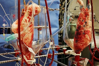 透過基因改造，豬肺也能為人類血液供氧