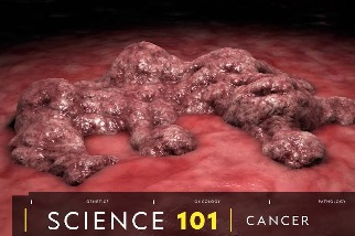 101科學教室：癌症