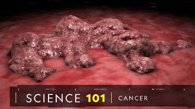 101科學教室：癌症