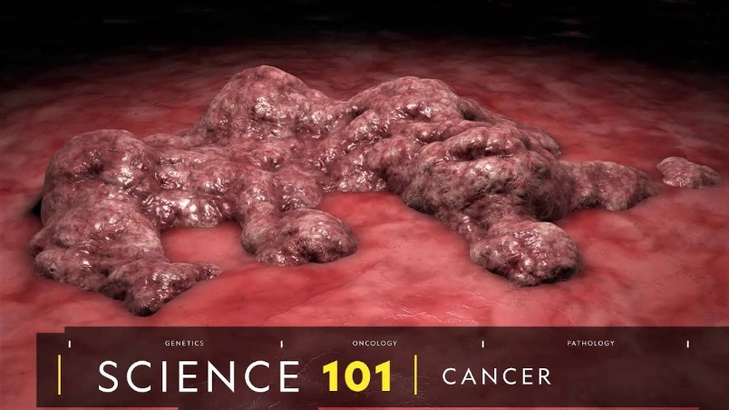 101科學教室：癌症